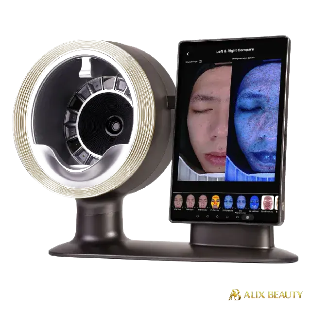 AI Face Scanner von Alix Lasers – Gerät für Gefäßbehandlung und Akne-Therapie
